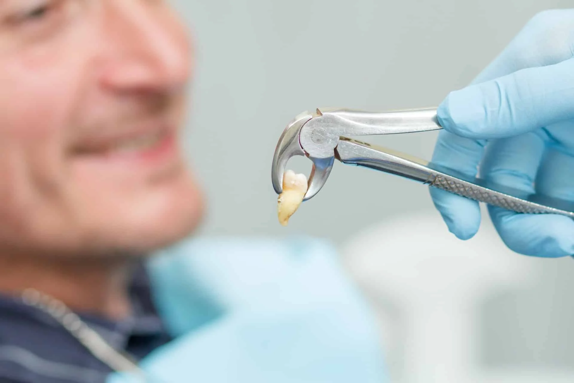 Replacement Tooth in Chula Vista | Bonita Del Rey