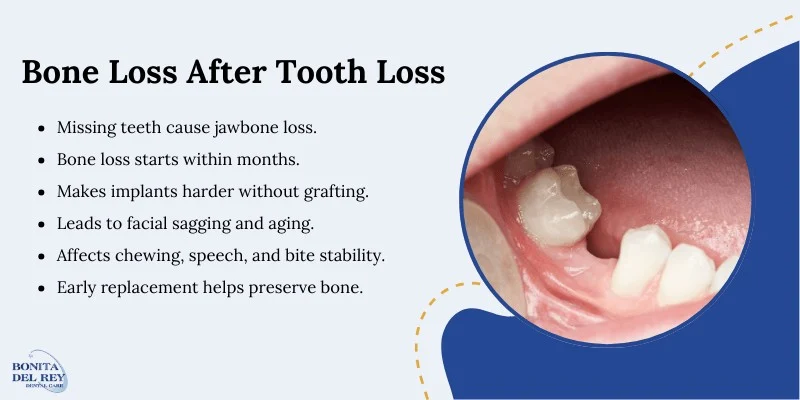 Bone Loss After Tooth Loss