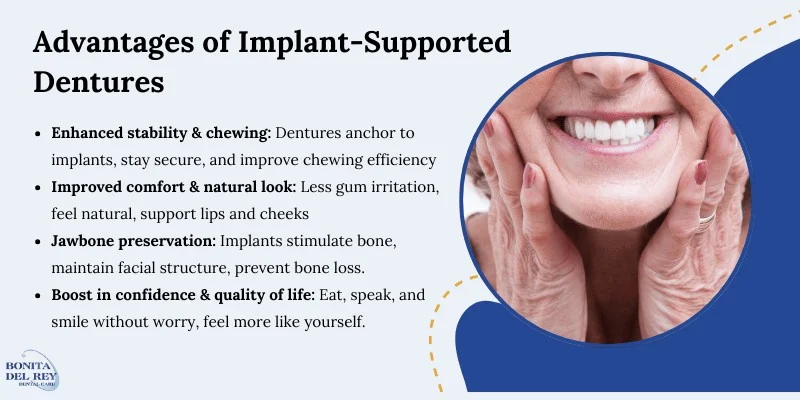 Advantages of implant-supported dentures