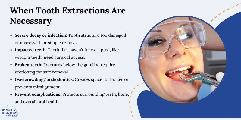 When tooth extractions are necessary