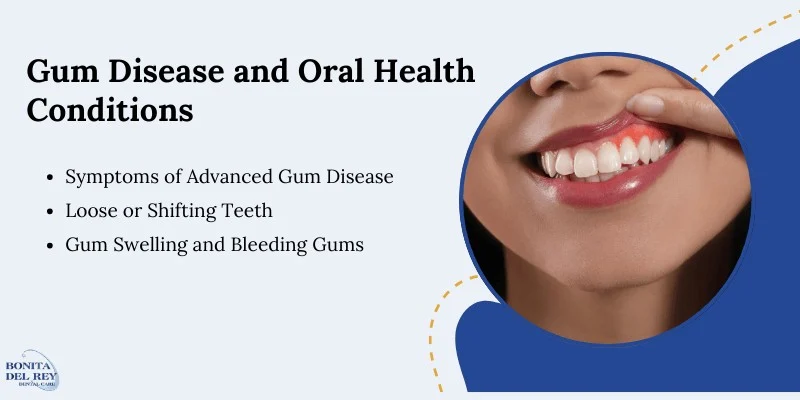 gum-disease-and-oral-health-conditions