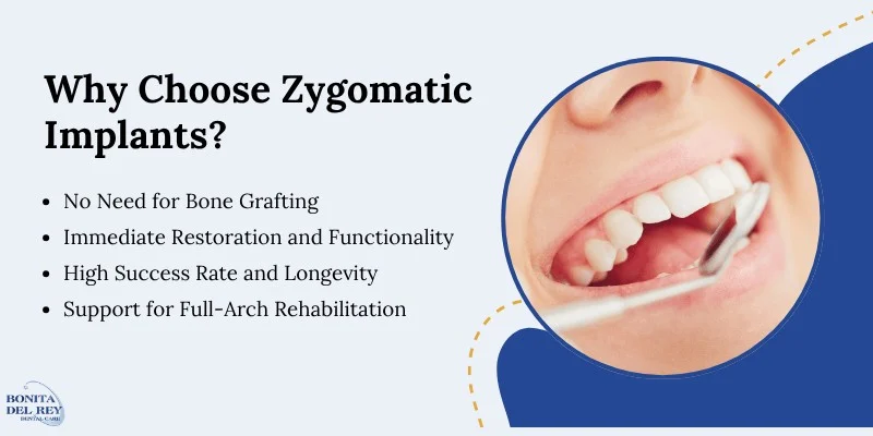 The Advantages of Zygomatic Implants