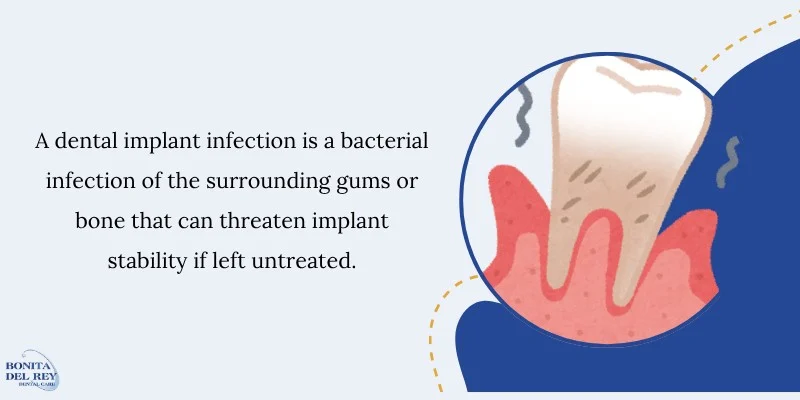 What Is a Dental Implant Infection