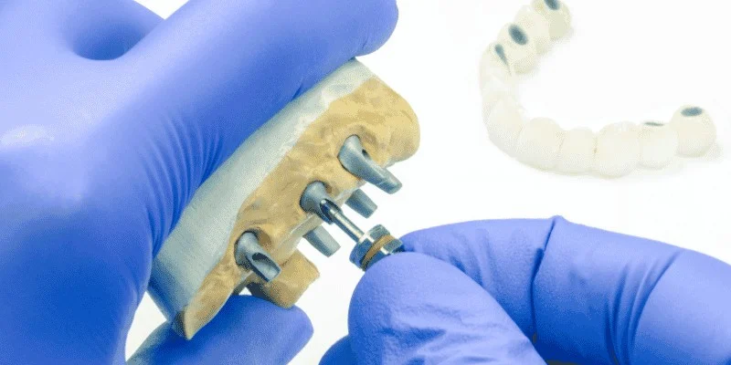 smoking dental implant success rate