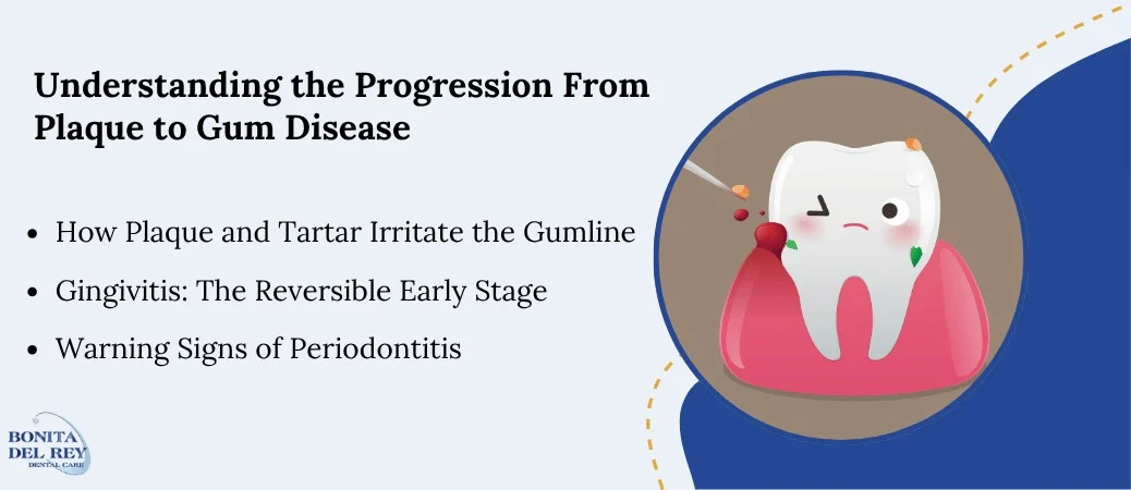 From Plaque Buildup to Periodontal Disease