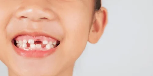 The Impact of Tooth Loss