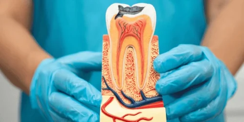 Why Dental Implants Fail Early 1