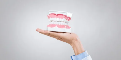all on 4 implants vs traditional implants