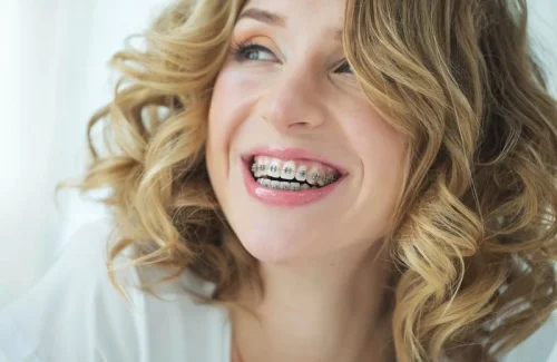 dental patient wearing braces